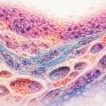 Gyógyító sejtek és csontok fejlődési rendellenességei, dysplasia fogalmával